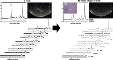 Improved Quantitative Fatty Acid Values with Correction of T2 Relaxation Time in Terminal Methyl Group: In Vivo Proton Magnetic Resonance Spectroscopy at Ultra High Field in Hepatic Steatosis