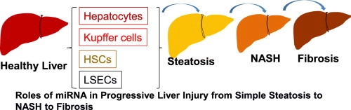 Role of MicroRNAs in the pathogenesis and treatment of progressive liver injury in NAFLD and liver fibrosis