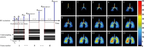 Considering low-rank, sparse and gas-inflow effects constraints for accelerated pulmonary dynamic hyperpolarized 129Xe MRI