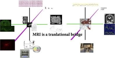 Recent advances in preclinical and clinical multimodal MR in the newborn brain