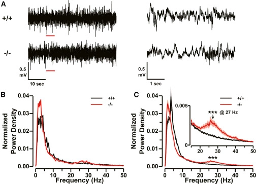 Biallelic Variants in CNPY3, Encoding an Endoplasmic Reticulum Chaperone, Cause Early-Onset Epileptic Encephalopathy