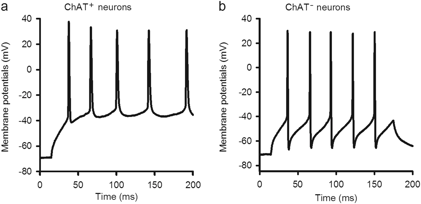 Propofol decreases the excitability of cholinergic neurons in mouse basal forebrain via GABAA receptors