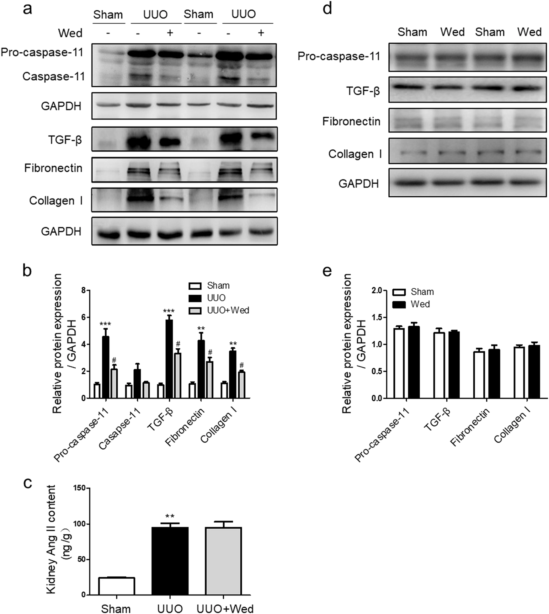 Caspase-11 promotes renal fibrosis by stimulating IL-1β maturation via activating caspase-1