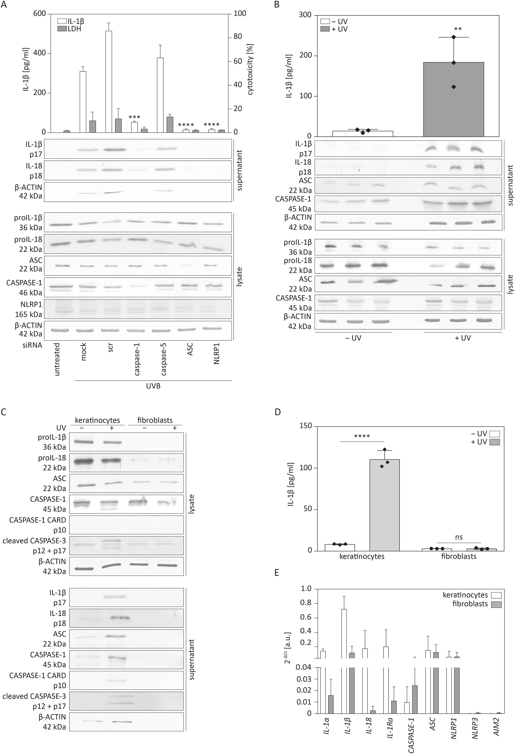 Expression of inflammasome proteins and inflammasome activation occurs in human, but not in murine keratinocytes