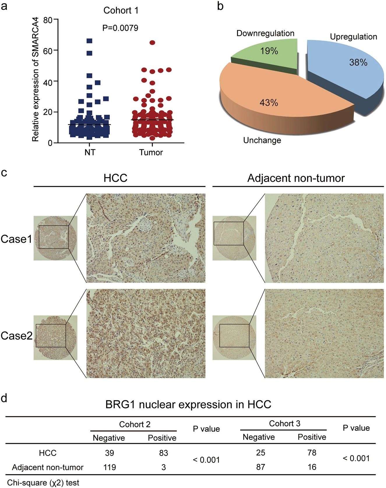 Hepatic SMARCA4 predicts HCC recurrence and promotes tumour cell proliferation by regulating SMAD6 expression