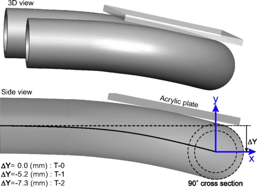 Secondary flow vortical structures in a ${180}^{∘}$ elastic curved vessel with torsion under steady and pulsatile inflow conditions