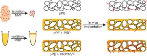 Biological coating with platelet-rich plasma and adipose tissue-derived microvascular fragments improves the vascularization, biocompatibility and tissue incorporation of porous polyethylene